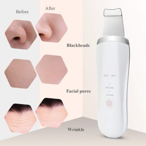 Facial Skin Ultrasonic Machine Cleansing Blackhead Massage Professional Skin Scrubber